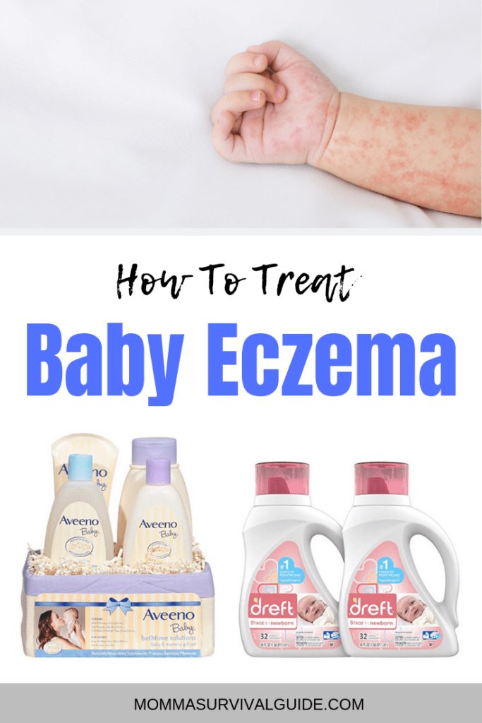 How To Treat Baby Eczema Help Your Baby’s Skin Momma Survival Guide